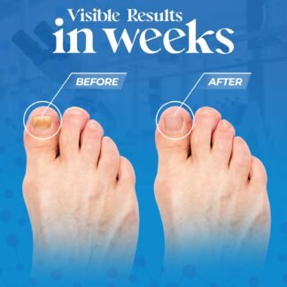 Aromasong Tea Tree Foot Soak with Magnesium Flakes and Dead Sea Foot Soaking Salts - Pedicure Tea Tree oil foot Soak for Dry Cracked Feet-Athlete's Callus Remover- Eliminates...