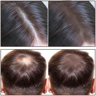 Boobeen Hairline Powder Stick for Thinning Hair, Grey Root Touch-Up and Hair Loss Concealer