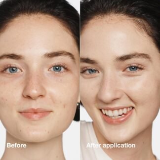 Clinique Even Better Makeup Liquid Foundation SPF 15 With Vitamin C For Dry + Oily Combination Skin Types | Medium Coverage + Natural Finish | Evens Skin Tone + Reduces Dark Spots