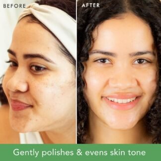 Facial Scrub Exfoliator - USA Made with Natural & Organic Ingredients, Gentle Exfoliating Face Wash for Sensitive & Acne Prone Skin, Microdermabrasion Scrub, Removes Dead Skin...