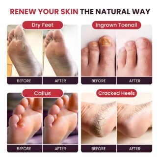 FOOT CURE Foot Soak with Epsom Salts – All-Natural Blend for Relaxing Foot Care – Softens Calluses & Refreshes Feet – Invigorating Scent, Spa Pedicure – 16 oz (Pack of 1)