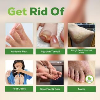 FOOT CURE Tea Tree Oil Foot Soak with Epsom Salt - Best Toenail Fungus Treatment, Athletes Foot & Softens Calluses - Soothes Sore & Tired Feet, Fungal Toe, Foot Odor Scent, Spa...