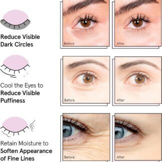 grace & stella Award Winning Under Eye Mask Reduce Dark Circles, Puffy Eyes, Undereye Bags, Wrinkles, Gel Under Eye Patches, Birthday Gifts for Women - Vegan - Thanksgiving...