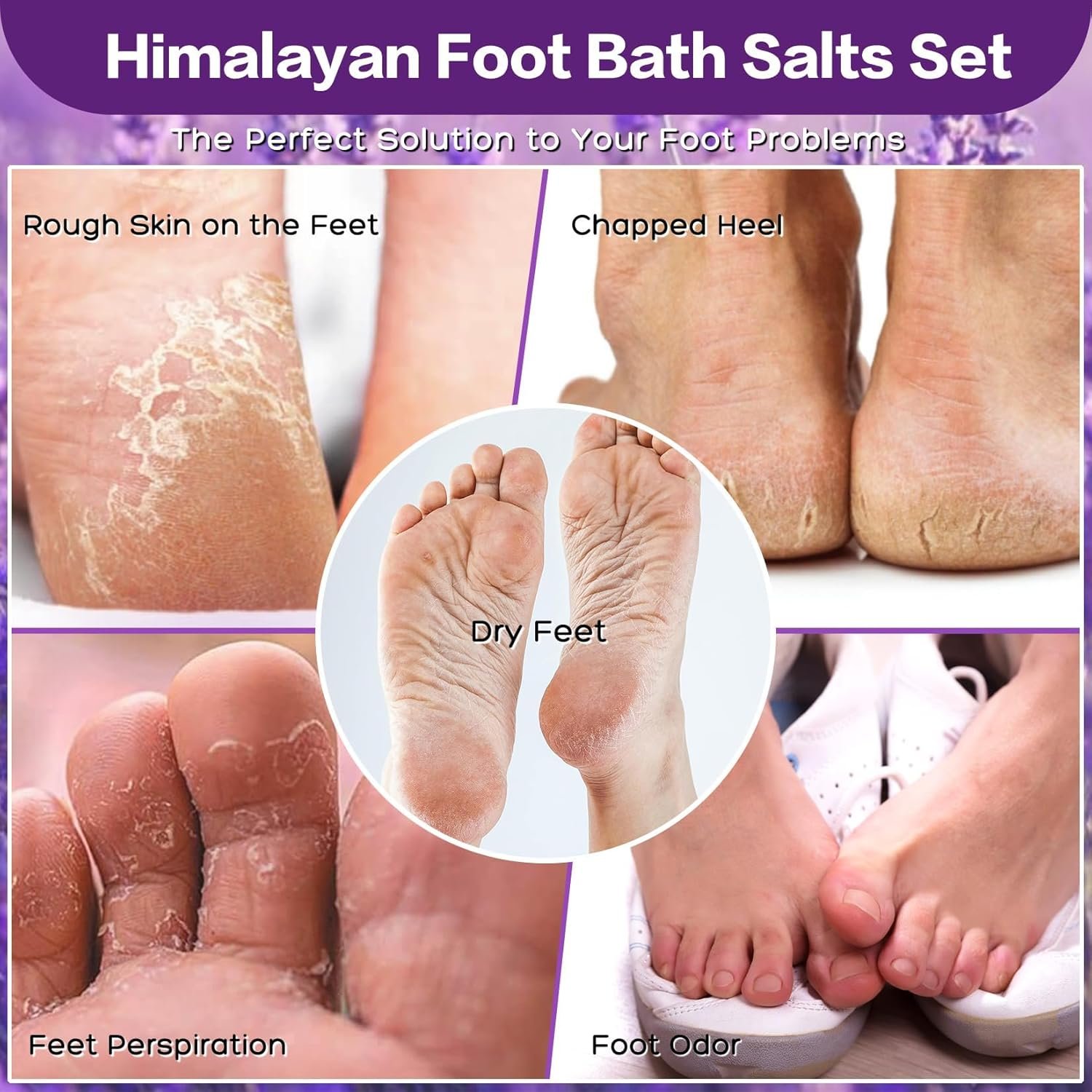 Himalayan Pink feet soka Salt 3 Set Kit Lavender Scent Orange Scent Rose Scent Foot Soak Salts with Epsom Set-Foot Athletes Foot spa ItchingFoot Bath Salt Tea Tree Oil Foot Care - lunas-mystic-emporium.com Himalayan Pink feet soka Salt 3 Set Kit Lavender Scent Orange Scent Rose Scent Foot Soak Salts with Epsom Set-Foot Athletes Foot spa Itching,Foot Bath Salt Tea Tree Oil Foot Care