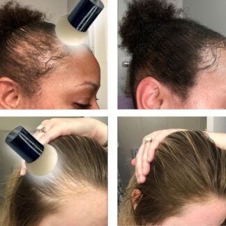 KERATIN RESEARCH Hairline Filler Unisex Mineral Powder Root Touch-Up Hair loss Concealer Scalp & Beard Bald Patch Coverage Fibers for Thinning Hair Waterproof Organic Natural...