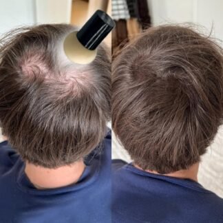 KERATIN RESEARCH Hairline Filler Unisex Mineral Powder Root Touch-Up Hair loss Concealer Scalp & Beard Bald Patch Coverage Fibers for Thinning Hair Waterproof Organic Natural...