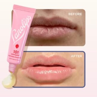 Lanolips 101 Ointment - Lanolin Lip Balm for Smooth, Hydrated & Healthy Lips - Multipurpose Lip Ointment with Lanolin Oil for Dry Lips, Cuticles & More - Strawberry (0.52 oz)