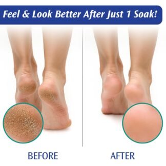 PediFix Soaking Crystals Foot Bath 6 Packets Therapeutic Foot Soak with Tea Tree Oil Epsom Salt for Sore Tired Achy Feet - lunas-mystic-emporium.com PediFix Soaking Crystals Foot Bath – 6 Packets – Therapeutic Foot Soak with Tea Tree Oil & Epsom Salt for Sore, Tired, Achy Feet