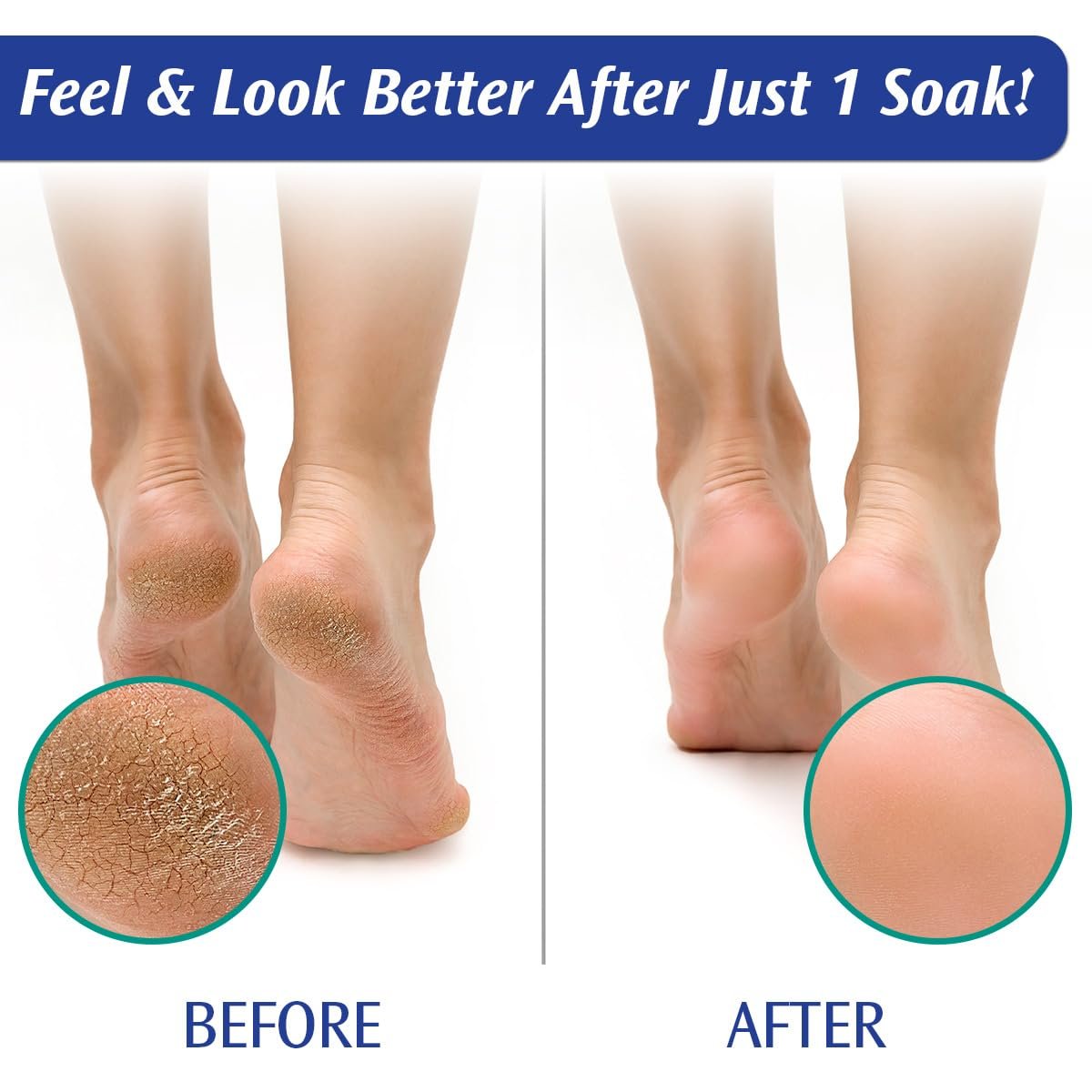 PediFix Soaking Crystals Foot Bath 6 Packets Therapeutic Foot Soak with Tea Tree Oil Epsom Salt for Sore Tired Achy Feet - lunas-mystic-emporium.com PediFix Soaking Crystals Foot Bath – 6 Packets – Therapeutic Foot Soak with Tea Tree Oil & Epsom Salt for Sore, Tired, Achy Feet