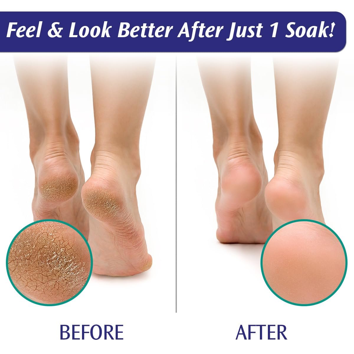 PediFix Soaking Crystals Foot Bath 6 Packets Therapeutic Foot Soak with Tea Tree Oil Epsom Salt for Sore Tired Achy Feet - lunas-mystic-emporium.com PediFix Soaking Crystals Foot Bath – 6 Packets – Therapeutic Foot Soak with Tea Tree Oil & Epsom Salt for Sore, Tired, Achy Feet