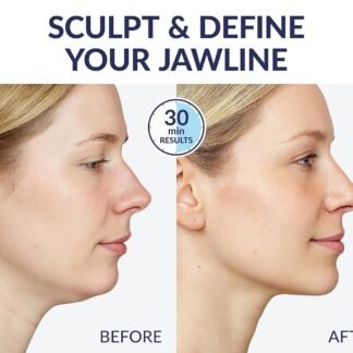 Stylia V Line Lifting Collagen Mask - Lift, Firm & Contour Jawline - Tightening Double Chin Strap with Hyaluronic Acid & Aloe - Neck Tightening and Lifting Mask - Jawline Shaper...