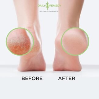 Tea Tree Oil Foot Soak with Epsom Salt - Made in USA - 16 Ounces