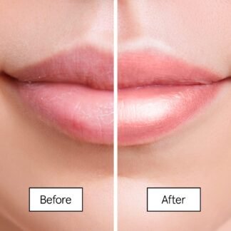 grace & stella Award Winning Lip Butter - Hydrating Lip Balm - Nourishing Lip Mask (1-pack) Travel Essentials, Travel Size Toiletries, Birthday Gifts for Women & Teens -...